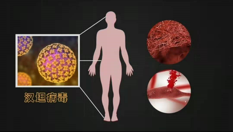 流行性出血热病毒.png